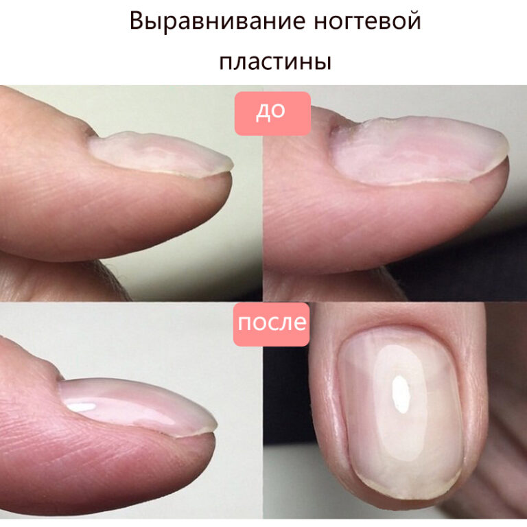Коррекция длины ногтевой пластины